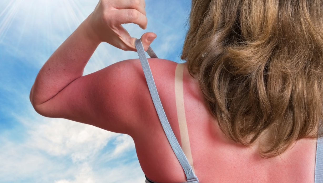 Can You Tan Through Clouds? WeatherStationPro